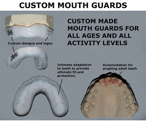 Custom Mouthguards | My Family Dentist