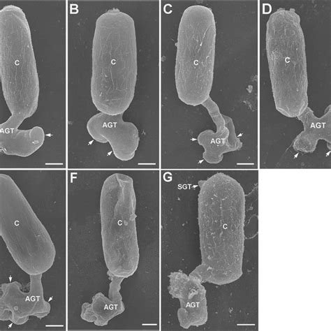 Scanning electron microscopy observation of conidia germination of Eej.... | Download Scientific ...