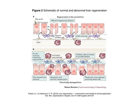 Figure 2 Schematic of normal and abnormal liver regeneration - ppt download