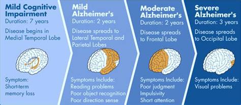 group_4_presentation_3_-_alzheimer_s_disease - Wiki