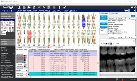 DentiMax Practice Management System | Free Demo, Reviews, And Pricing 2024 | EMRFinder