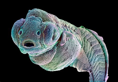 Zebrafish embryo [electronic resource] | Wellcome Collection