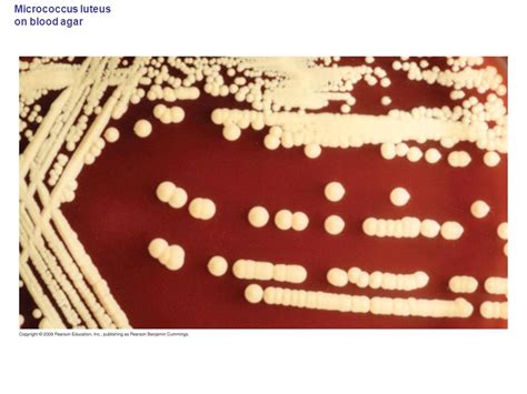 Micrococcus luteus antibiotic treatment