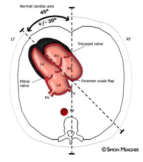 Normal fetal echocardiogram | Radiology Case | Radiopaedia.org | Obstetric ultrasound ...