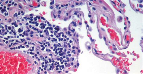 Hematoxylin and Eosin (H&E) Stain | Lab Tests Guide