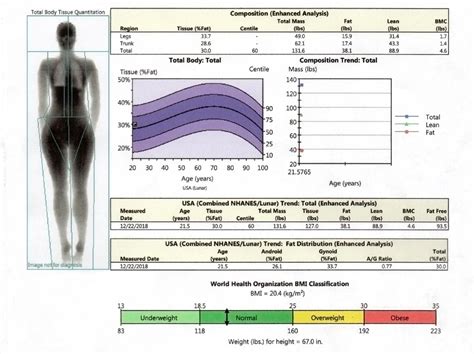 Bone Density Scan Results / Bone densitometry - The more bone material ...