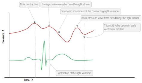 Interpretation of the central venous pressure waveform | Deranged ...