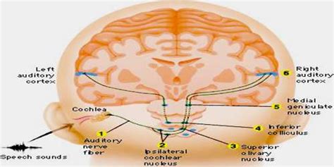 Auditory Cortex - Assignment Point