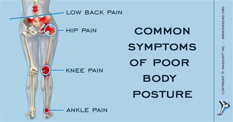 What Is Malalignment Syndrome? | MASS4D® Insoles - MASS4D® Foot Orthotics