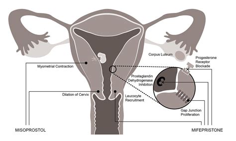 Mechanism of Action Mifepristone and Misoprostol_greyscale… | Flickr