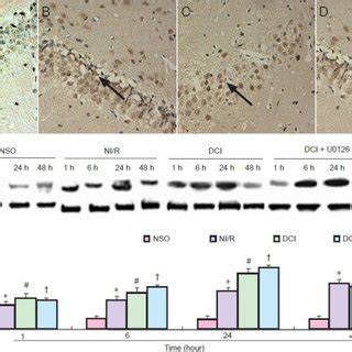 Effects of extracellular signal-regulated kinase 1/2 pathway inhibition... | Download Scientific ...