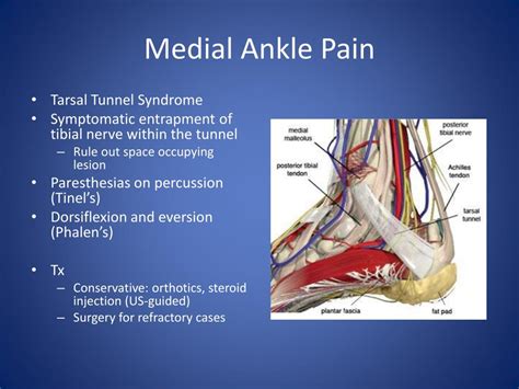 PPT - Chronic Ankle Pain PowerPoint Presentation, free download - ID:1370541