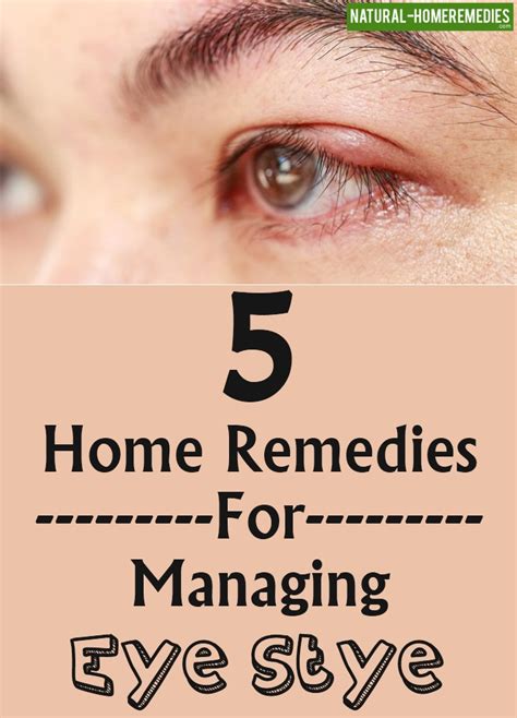 5 Amazing Home Remedies For Managing Eye Stye – Natural Home Remedies ...