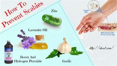 14 Tips On How To Prevent Scabies At Home