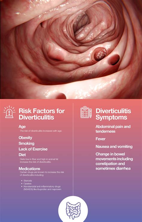 Diverticulosis and Diverticulitis Explained – The Amino Company