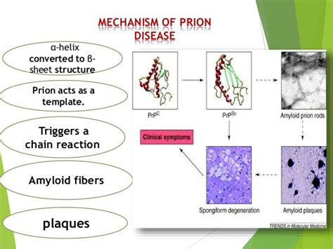 Prion disease