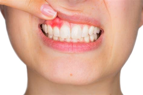 Periodontics in Southampton | Treating gum disease | Octagon Dental Centre