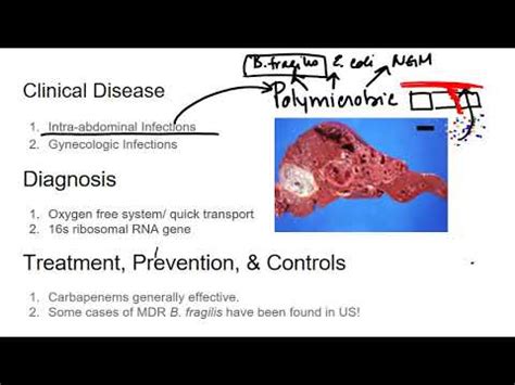 Bacteroides fragilis: characteristics, morphology, pathologies ...