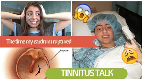 THE TIME MY EARDRUM RUPTURED AND I GOT TINNITUS | STORYTIME (story, surgery, recovery) - YouTube