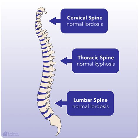 Kyphosis and Hyperkyphosis - What it is, how it happens, and what to do