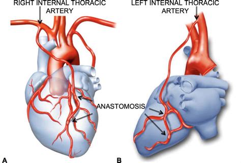 Internal Thoracic Artery