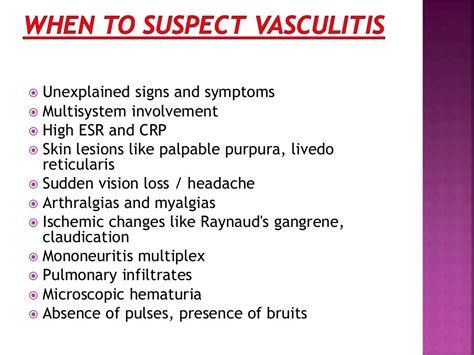 Vasculitis Treatment