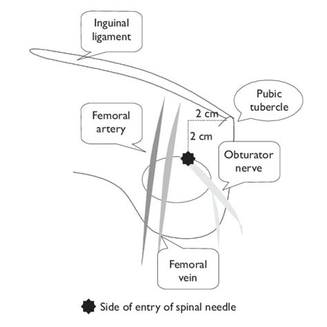 The anatomy of the obturator nerve as it emerges through the obturator ...