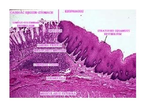 HISTOLOGY OF ESOPHAGUS GASTRO ESOPHAGEAL JUNCTION By Dr