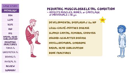 Pediatric musculoskeletal disorders: Pathology review | Osmosis