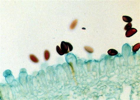 Basidia Microscope