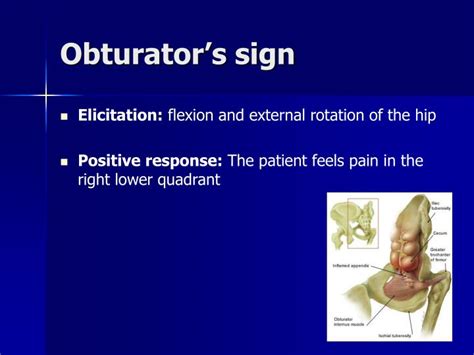 Right Hip Ache X Ray – The Hip Flexor