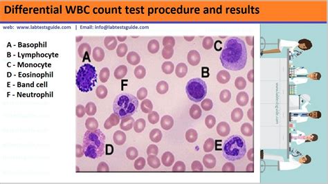 Differential WBC Count Test Procedure | Lab Tests Guide