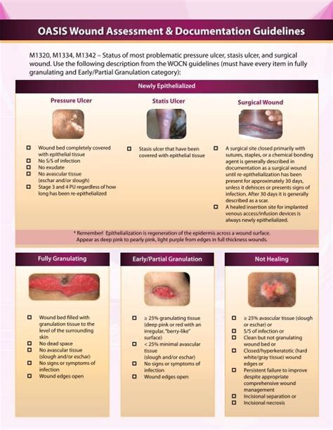 OASIS Wound Assessment & Documentation Guidelines