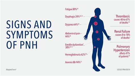 Paroxysmal Nocturnal Dyspnea, Adjusted Odds Ratios For Orthopnea ...