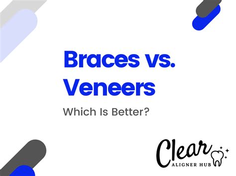 Braces vs. Veneers: Which Is Better in 2022?