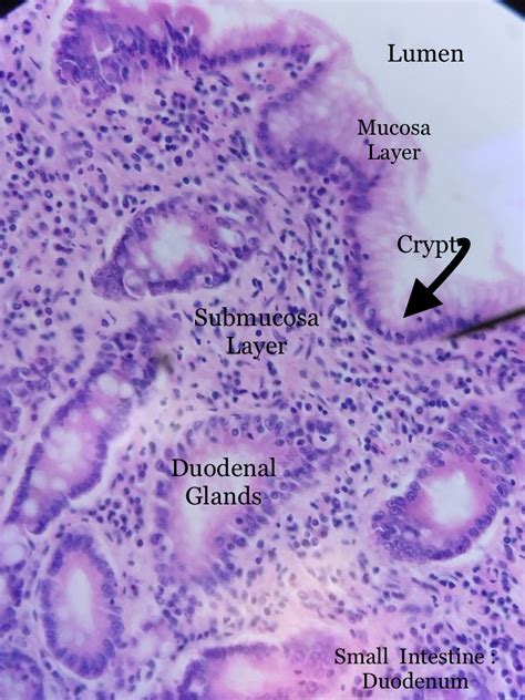 Duodenum Histology.