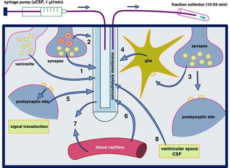 The diagnostic accuracy of brain microdialysis during surgery ...