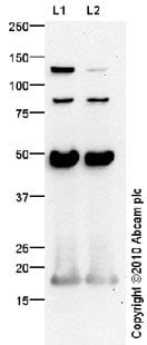 Anti-MCP1 antibody (ab73680) | Abcam