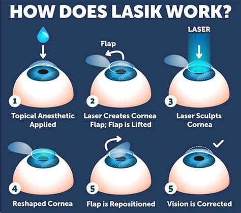 Femto LASIK: Prices from 4000 AED per Eye