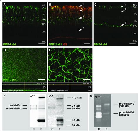 Expression of MMP-2 in the healthy adult mouse retina. a Immunostaining ...