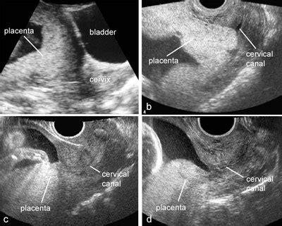 Ultrasound Atlas | GLOWM