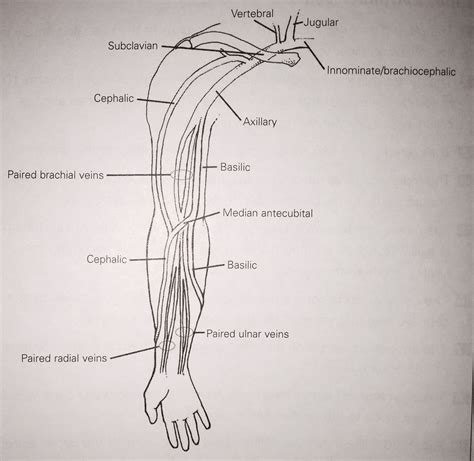 Upper Extremity Veins | Ultrasound sonography, Diagnostic medical ...