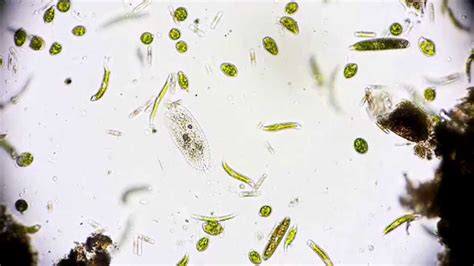 Wimpertierchen - Ciliophora - Hypotrichida - Ciliata - microorganisms ...