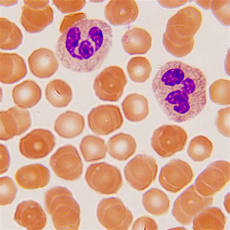 Differential Quik Stain Kit (Modified Giemsa)