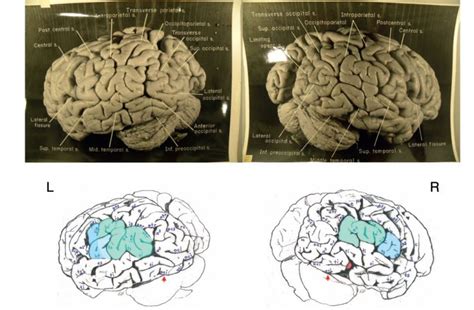 On Albert Einstein’s Unusual, but Average-Sized, Brain – Books I Read