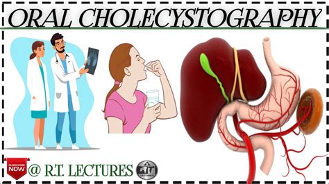 #Oral Cholecystography procedure/Investigation in hindi/English #what ...