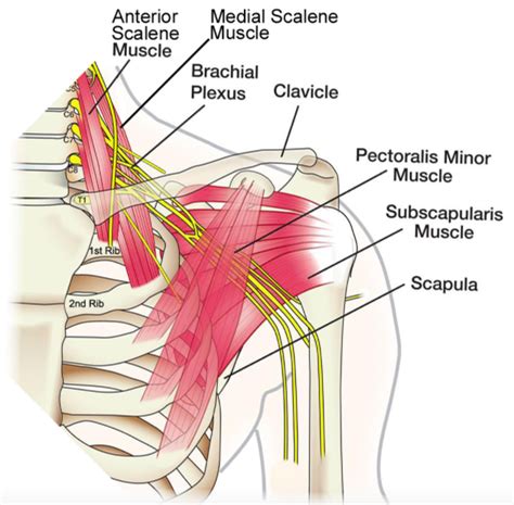 Shoulder Pain - Chiropractor in Amherst, NY