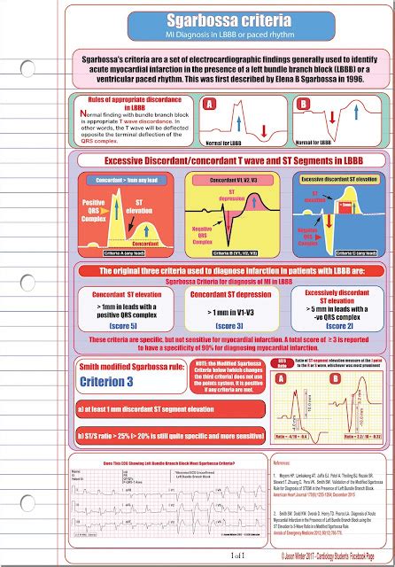 ECG Educator Blog : Sgarbossa criteria