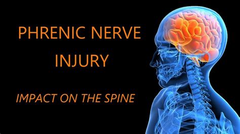 PHRENIC NERVE INJURY IMPACT ON THE SPINE #MedEd #UHN #kyphosis - YouTube