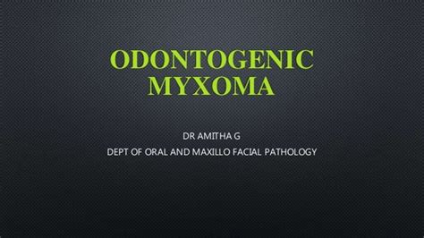 Odontogenic Myxoma